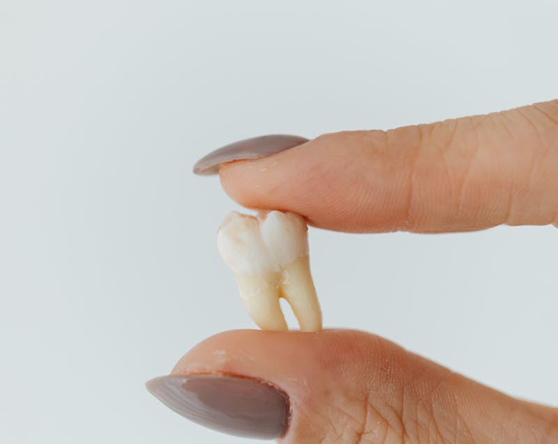 a knocked-out tooth